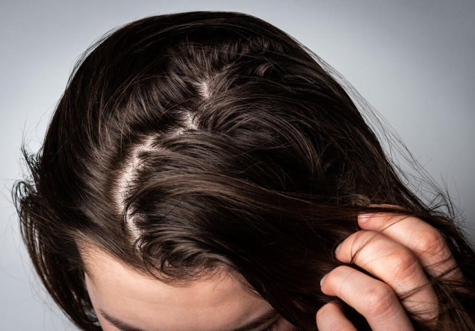 NEMOJTE PRETJERIVATI: Greška broj jedan zbog koje vam se kosa zamasti već dan nakon pranja
