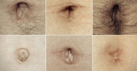 RECITE NAM KOJI OBLIK PUPKA IMATE, A MI ĆEMO VAM REĆI OD ČEGA BOLUJETE: Mnogima je pogodilo, OBRATITE PAŽNJU