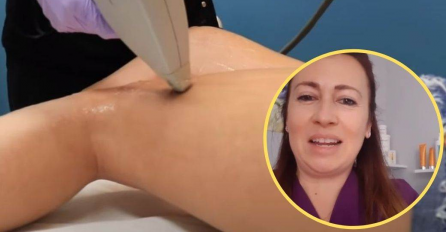 LASER PEČE? BJEŽITE IZ TOG SALONA: Doktorica otkrila PRAVU ISTINU o UKLANJANJU NEŽELJENIH DLAČICA 