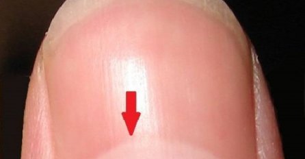 ZNATE LI ŠTA ZNAČI POLUMJESEC NA VAŠIM NOKTIMA? Važniji je nego što mislite, MNOGI NE ZNAJU ZA OVO