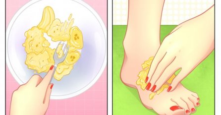 IZGNJEČITE BANANU PA NAMAŽITE STOPALO OVOM SMJESOM: Spas za mnoge probleme, ISPROBAJTE OVE TRIKOVE