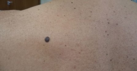 "JA IMAM, A VI?" MNOGE ŽENE IMAJU MLADEŽ NA SREDINI ZGLOBA: Svi se pitaju zašto, sada je stigao odgovor!