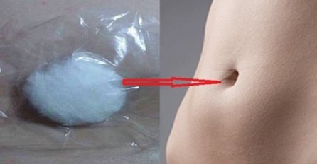 SVAKA ŽENA ZASLUŽUJE DA OVO ZNA: Stavila je NATOPLJENU VATU U PUPAK, a nakon 25 minuta pozvala je sve prijateljice da im ispriča šta joj se dogodilo!