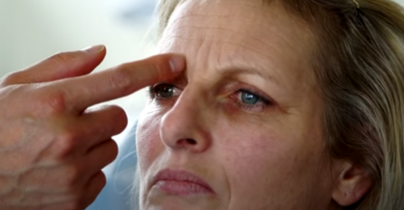 OVI DIJELOVI LICA NAJBRŽE STARE NA SUNCU: Njih nikako ne smijete da sunčate bez zaštitnog faktora