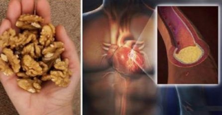 POJEDITE 5 ORAHA I SAČEKAJTE 4 SATA, EVO ŠTA ĆE VAM SE DESITI: Rezultat je fenomenalan - ODMAH ISPROBAJTE