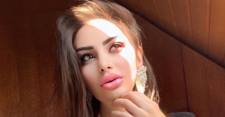 Kristina Mandarina ponovno imala zahvat na usnama, evo kako sada izgleda