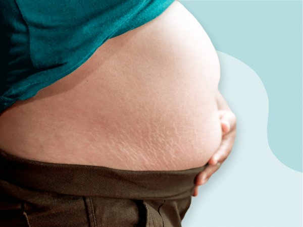 b-belly-pregnancy-732x549-thumbnail