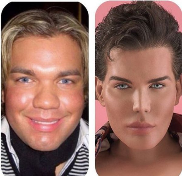 rodriguez-surgery-timeline