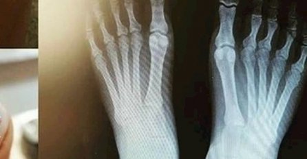 OTIŠLA JE DA SNIMI RENDGENSKE SLIKE STOPALA: Zbog 1 detalja se doktor UHVATIO ZA STOMAK OD SMIJEHA, evo šta je na slici