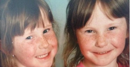 Do osme godine bile su sasvim obične bliznakinje: Danas imaju 26 godina i PRETVARAJU SE U KAMEN, LJEKARI SU IM SAOPŠTILI TEŠKE VIJESTI