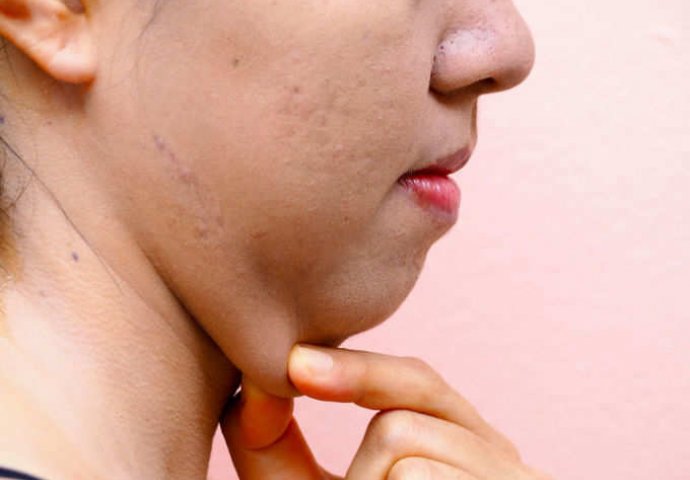 NEMOJTE ZANEMARIVATI: 10 promjena na tijelu koje govore mnogo o vašem zdravlju! MOGU NASTATI OZBILJNI PROBLEMI