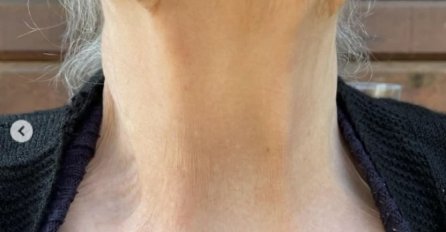 MNOGI NE OBRATE PAŽNJU NA SVRAB, ALI MOŽE BITI SIMPTOM OPASNE BOLESTI: Ovo je 10 razloga zbog čega koža može da svrbi