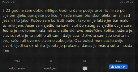 "S 23 godine sam dobio vitiligo"