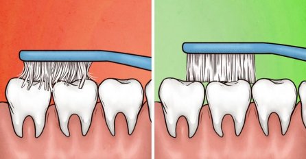 UNIŠTIT ĆETE VAŠE DESNI: 4 znaka da četkate zube PREJAKO: Evo kako možete popraviti