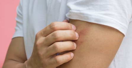 MNOGI NE OBRATE PAŽNJU NA SVRAB, ALI MOŽE BITI SIMPTOM OPASNE BOLESTI: Ovo je 10 razloga zbog čega koža može da svrbi