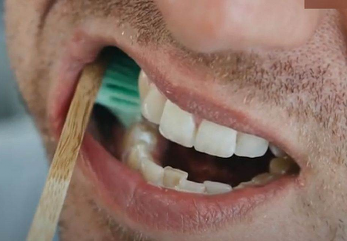 Naučnici otkrili superorganizam koji šteti našim zubima