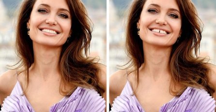 OVE SLIKE POKAZUJU KOLIKO ZUBI MOGU PROMIJENITI IZGLED VAŠEG LICA: A tek da vidite broj 5 - potpuno druga osoba (FOTO)