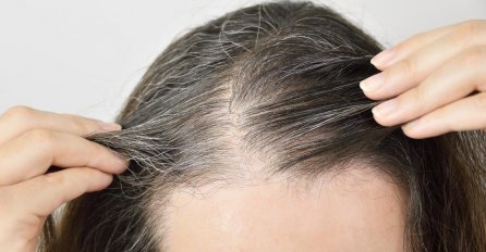 KOSA VAM OPADA VIŠE NEGO INAČE? OVAJ SIMPTOM NE ZANEMARUJTE: Evo na šta vas organizam upozorava