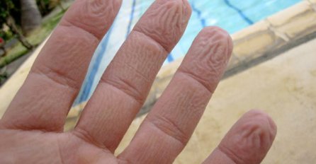 KONAČNO OTKRIVENO: Znate li pravi razlog zašto se prsti smežuraju kada su u vodi?
