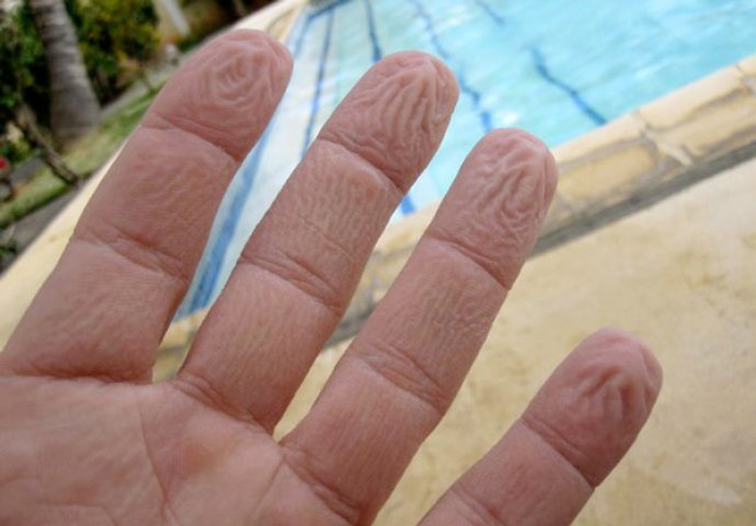 KONAČNO OTKRIVENO: Znate li pravi razlog zašto se prsti smežuraju kada su u vodi?