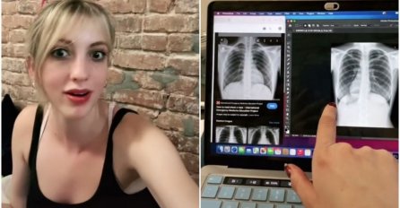 Ova djevojka otišla u bolnicu, a zbog onoga što su u bolnici vidjeli na rendgenu DOKTORI OSTALI U NEVJERICI