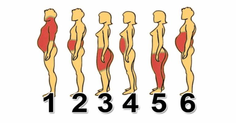 types-of-obesity1