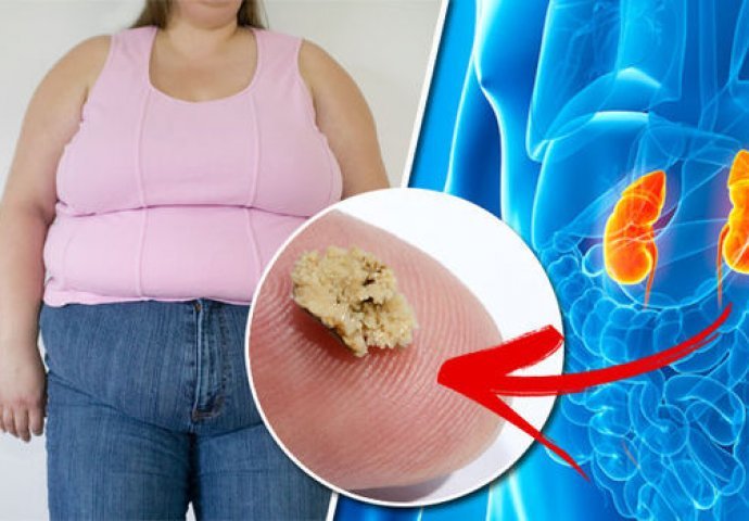 RJEŠAVA PROBLEM VEOMA BRZO I BEZ IKAKVIH BOLOVA: Izbacite kamen iz bubrega ovom JEFTINOM ŽITARICOM! 