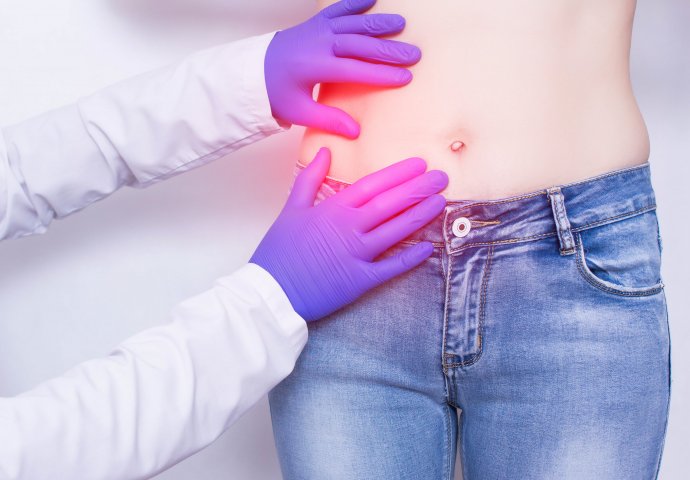 KAKO BOLI SLIJEPO CRIJEVO: Koji su simptomi i kako se liječe upala i pucanje slijepog crijeva