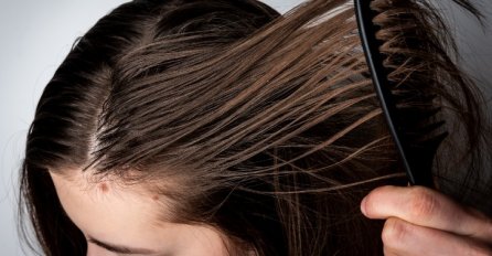 JEFTIN TRIK da se zauvijek riješite MASNE KOSE! Napravite prirodno sredstvo za čisto i bujno vlasište