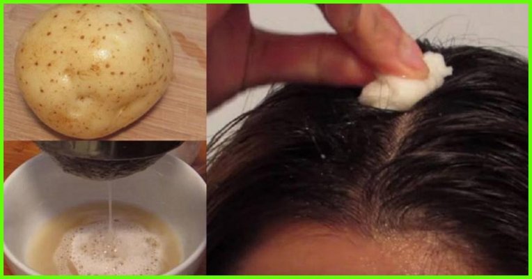 how-to-use-potato-juice-for-hair-growth-1