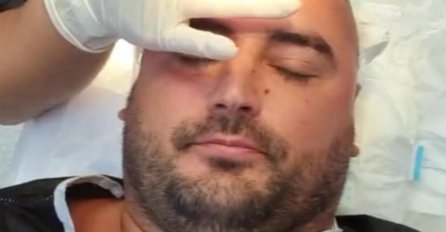 ALEN HADROVIĆ SE OGLASIO NAKON TRANSPLATACIJE, PRVA IZJAVA ZA MEDIJE: Bio budan cijelu operaciju, otkrio sve o zahvatu