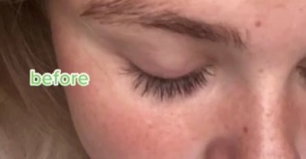 DJEVOJKA JE KUPILA SKUP SERUM ZA RAST TREPAVICA, A ONDA SU ONE POČELE DA RASTU I RASTU, I BUJAJU: Pogledajte kako sada izgleda (FOTO)