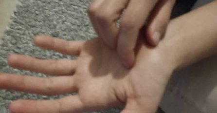 STIŽU PARE ILI? Evo šta zapravo znači kad vas svrbi lijevi dlan