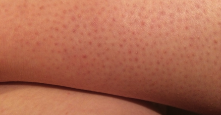 CIJELO VRIJEME SE POGREŠNO DEPILIRATE I ZATO VAM DLAČICE BRZO RASTU: Otkrivamo vam trik - ovako će vam noge biti danima glatke