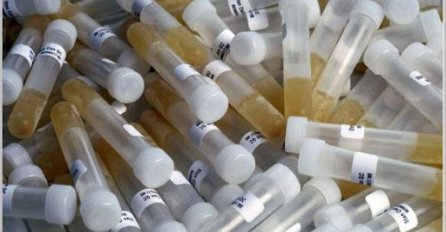 ZAŠTO IMATE JAK I NEPRIJATAN MIRIS URINA: Ovaj znak organizma ne smijete zanemariti! EVO NA ŠTA VAS UPOZORAVA