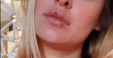 RANE NA LICU, LUNA ĐOGANI OBJAVILA NAJNOVIJU SLIKU: Neće više da šuti, evo šta se dešava ima 2 mjeseca (FOTO)