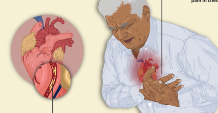 ŠTA SE DEŠAVA 24 SATA PRIJE INFARKTA: Ne paničite ako vas zaboli u grudima - ovo su iznenađujući simptomi srčanog udara