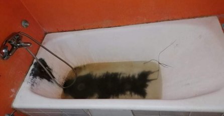 Objavljene slike kupatila na Dječijoj pulmologiji u UKC-u RS: Roditelji ogorčeni (FOTO)