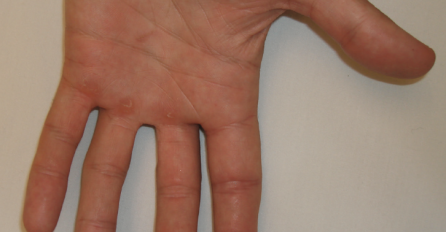 DA LI VAM TRNU RUKE ILI PRSTI? EVO NA ŠTA VAS UPOZORAVA OVAJ SIMPTOM: Na vrijeme obratite pažnju