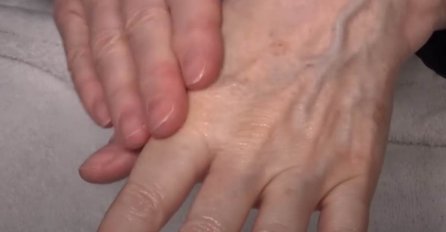 Ovo su prvi simptomi raka kostiju: Bolest često počinje bez znakova, ali ako ovo primijetite odmah idite doktoru