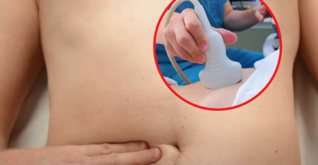 KAKO PREPOZNATI MASNU JETRU: Može da vodi u hepatitis ili cirozu - OBRATITE PAŽNJU NA OVAJ SIMPTOM