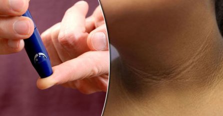 11 SIMPTOMA UPOZORENJA: Ovo su znakovi da možda imate VISOK ŠEĆER U KRVI, obratite pažnju na vrijeme
