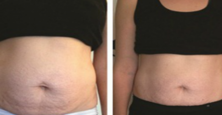 ZBOG OVAKVOG DORUČKA SE DEBLJATE: 1 namirnica goji i stvara naslage na stomaku, a svi je jedete - NIJE HLJEB