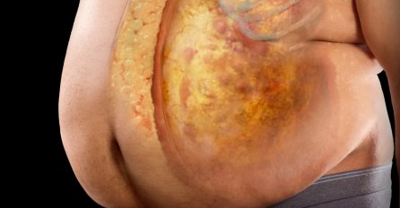 Evo kako da se riješite MASNOG STOMAKA I OČISTITE JETRU: Napravite napitak od OVE BILJKE -  prepolovit ćete se i bit ćete zdraviji