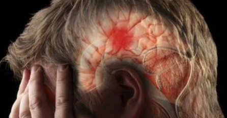 80 posto moždanih udara može se spriječiti. Neurologinja otkrila kako