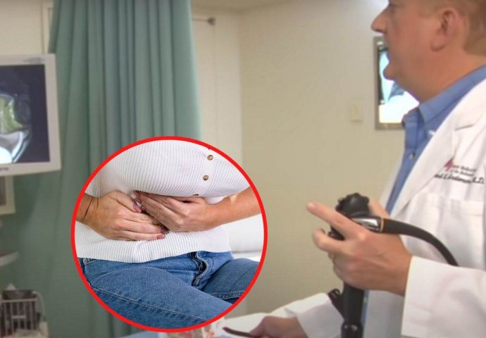 KO OVO ZNA O RAKU DEBELOG CRIJEVA, MOŽE DA SPASI ŽIVOT: Koji su polipi opasni i kako spriječiti nastanak karcinoma