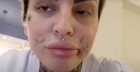ŽENO, ŠTA TI SE DESILO S LICEM? Jelena Krunić prije 10 godina nije imala PLASTIKU, nazivaju je HODAJUĆOM NAKAZOM! (FOTO)