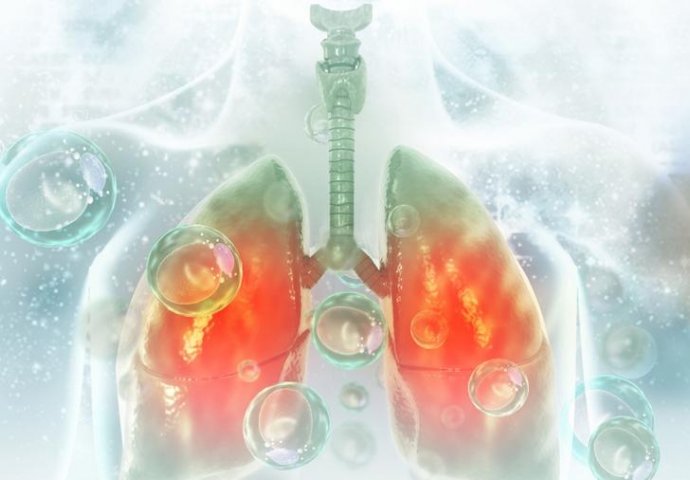 6 SIMPTOMA PRITAJENE PNEUMONIJE: Sigurni znakovi da se infekcija proširila na pluća!