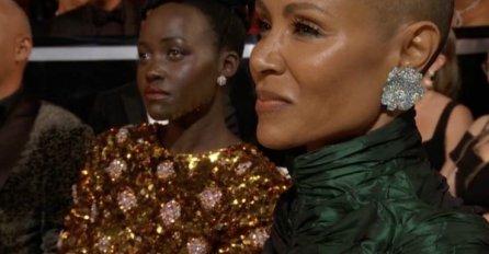 ŠTA JE ALOPECIJA OD KOJE BOLUJE SUPRUGA WILL SMITHA? Evo kako nastaje ova bolest, OVOJE GLAVNI SIMPTOM