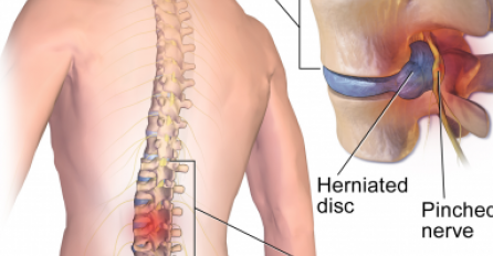 BOLE VAS LEĐA DANIMA? Hitno morate kod ljekara ako osjećate još 1 simptom sa ove liste